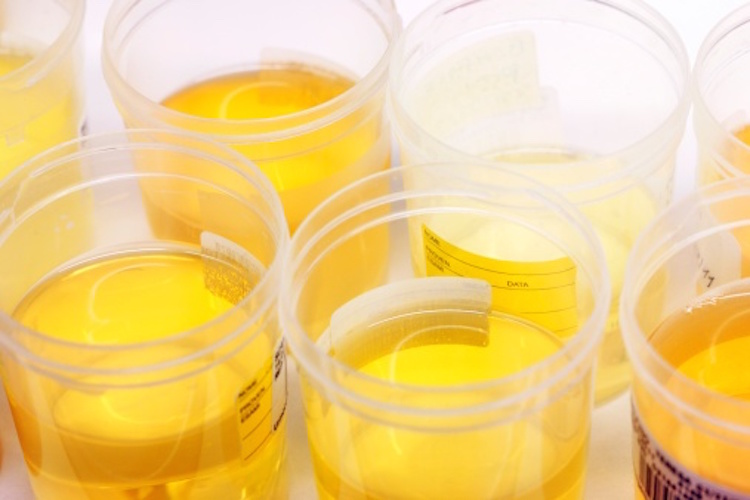 срок хранение в урине